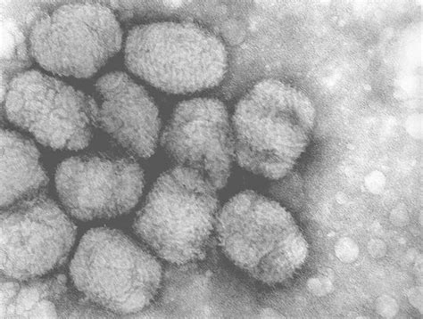 Alaskapox Virus Png